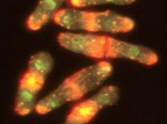 The cytoskeleton in human pathogenic fungi