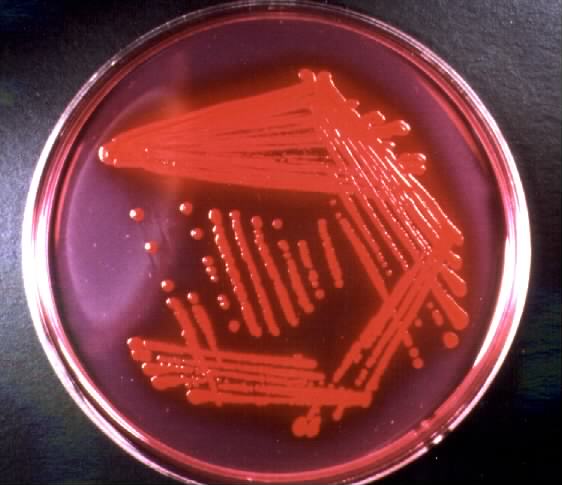 E.coli - culture on  Endo agar. Click to zoom.
