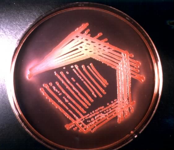 E.coli - culture on MacConkey agar. Click to zoom.