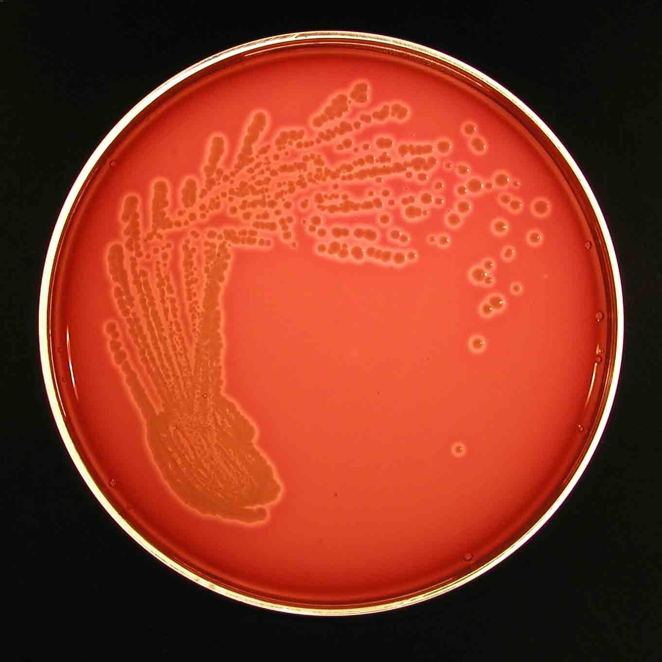 E.coli - hemolytic strain . Click to zoom.