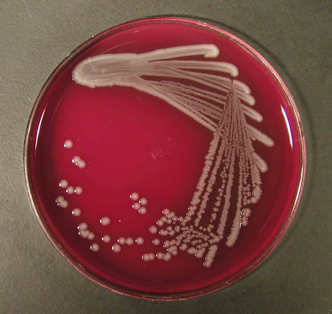 E.coli - culture on sheep blood agar. Click to zoom.