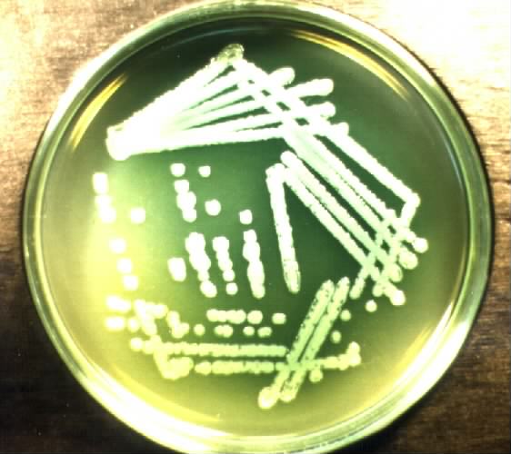 P.aeruginosa - culture - strain with bacteriophage . Click to zoom.