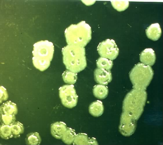 P.aeruginosa - colonies with bacteriophage, detail. Click to zoom.
