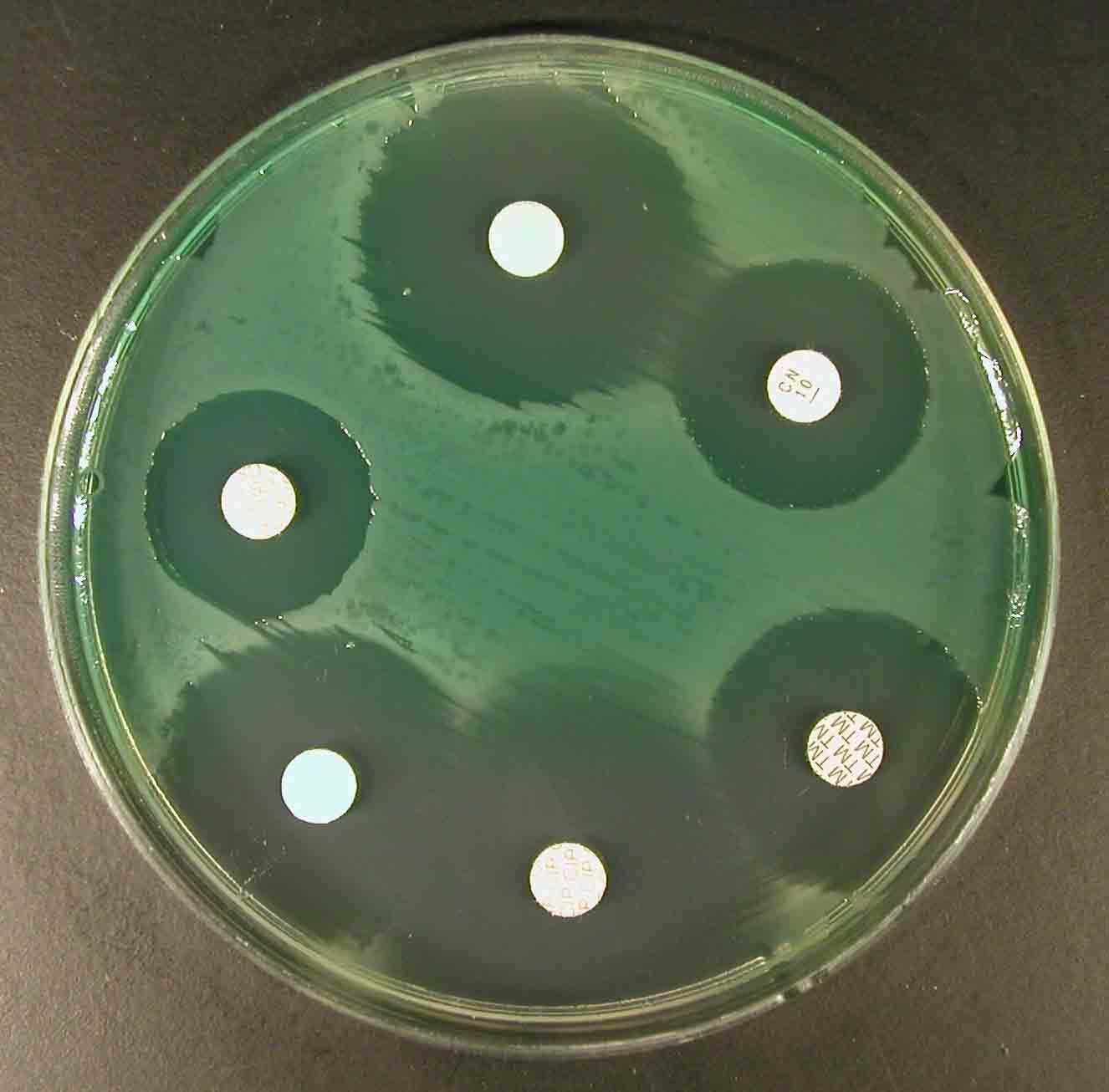 P.aeruginosa - diffusion disc test. Click to zoom.